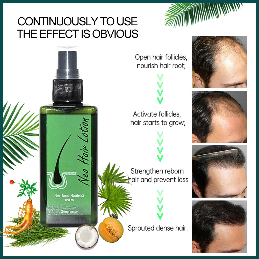 Oryginalny Neo Hair Lotion 120 – Hair Care Gisou recenzja i cena